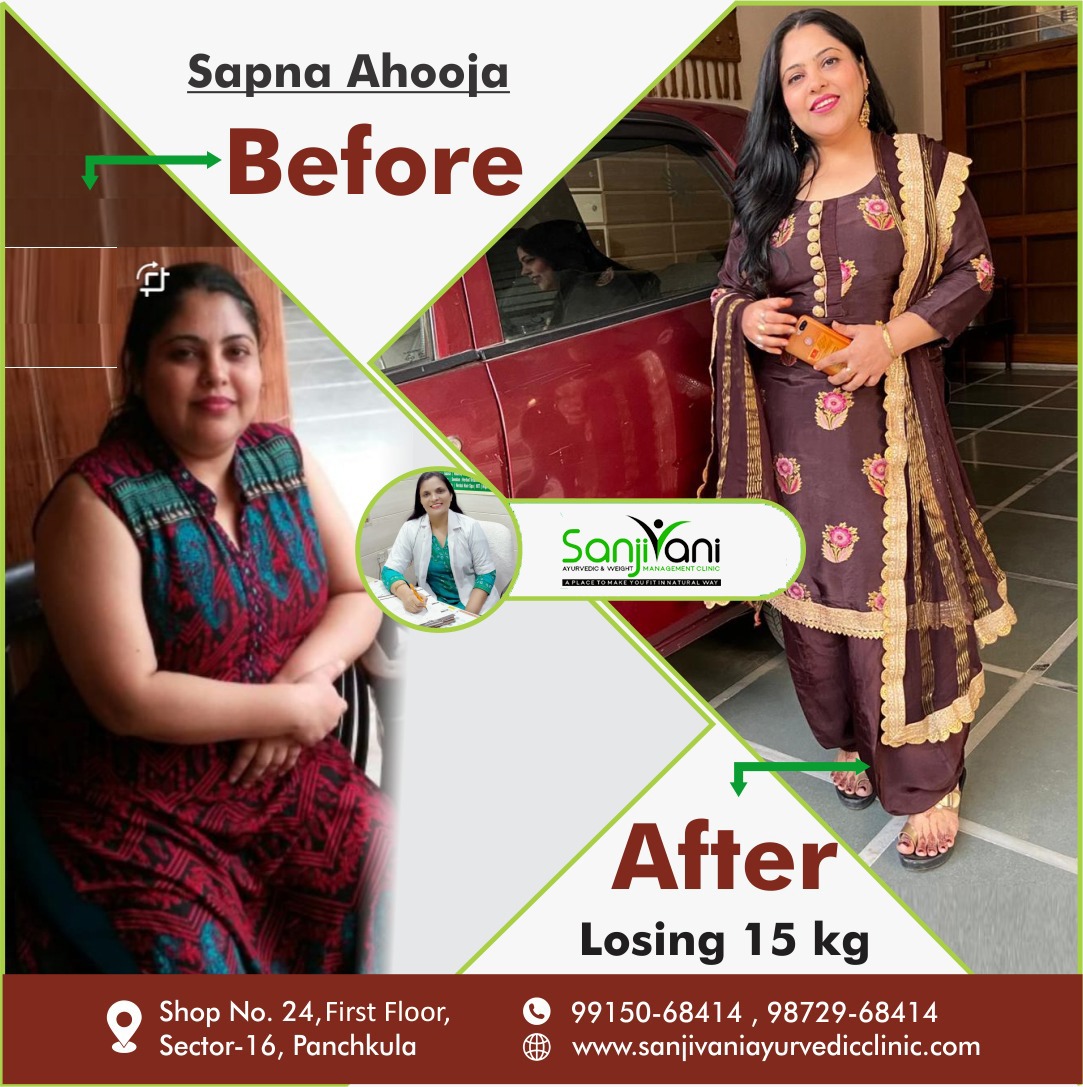 Natural Ayurvedic weight management results at Sanjivani Clinic Panchkula